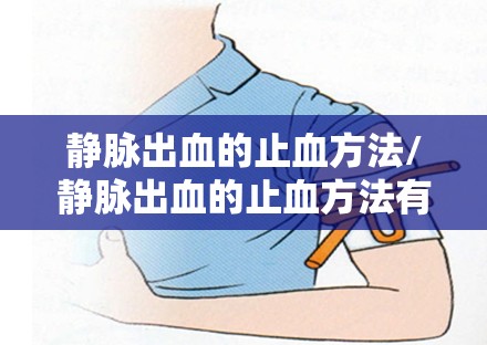 静脉出血的止血方法/静脉出血的止血方法有哪些