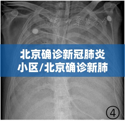 北京确诊新冠肺炎小区/北京确诊新肺炎病例小区