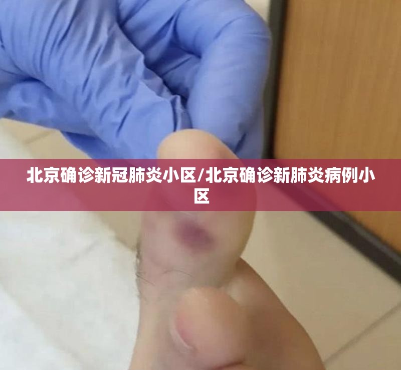 北京确诊新冠肺炎小区/北京确诊新肺炎病例小区