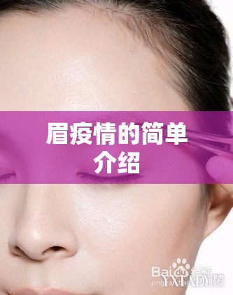 眉疫情的简单介绍