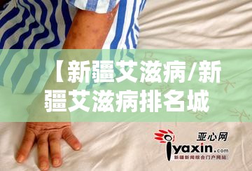 【新疆艾滋病/新疆艾滋病排名城市】