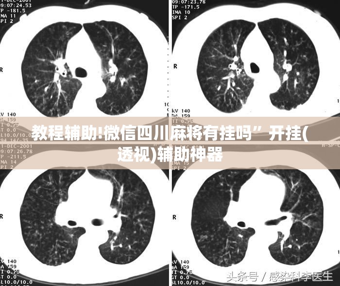 教程辅助!微信四川麻将有挂吗”开挂(透视)辅助神器