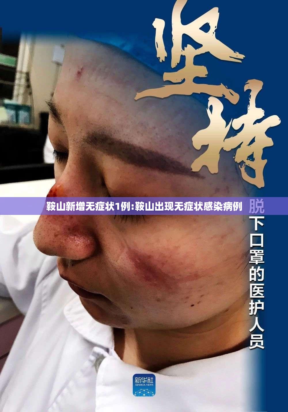 鞍山新增无症状1例:鞍山出现无症状感染病例