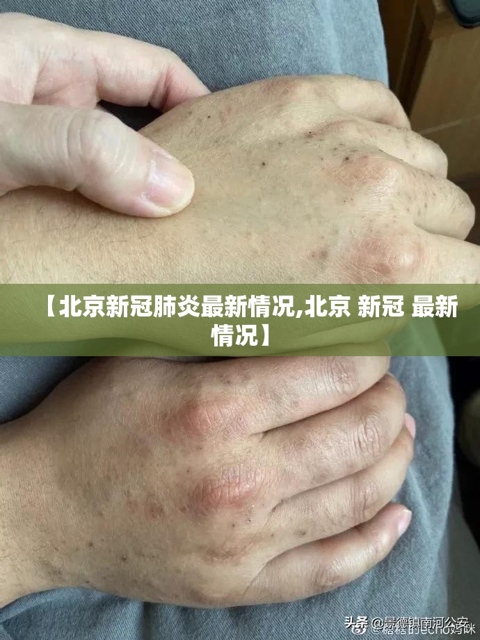 【北京新冠肺炎最新情况,北京 新冠 最新情况】