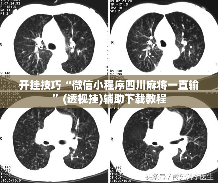 开挂技巧“微信小程序四川麻将一直输	”(透视挂)辅助下载教程