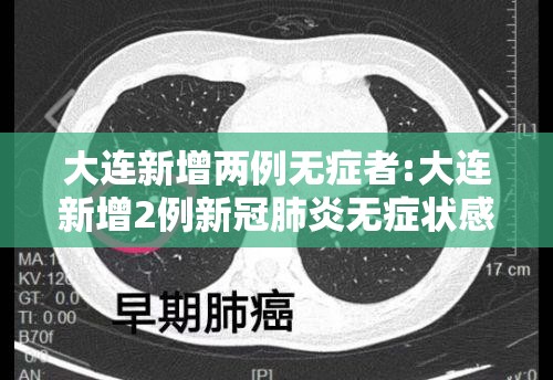 大连新增两例无症者:大连新增2例新冠肺炎无症状感染者