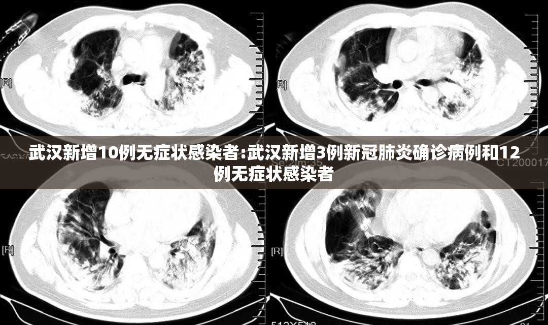 武汉新增10例无症状感染者:武汉新增3例新冠肺炎确诊病例和12例无症状感染者