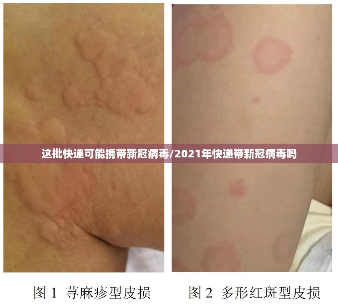这批快递可能携带新冠病毒/2021年快递带新冠病毒吗