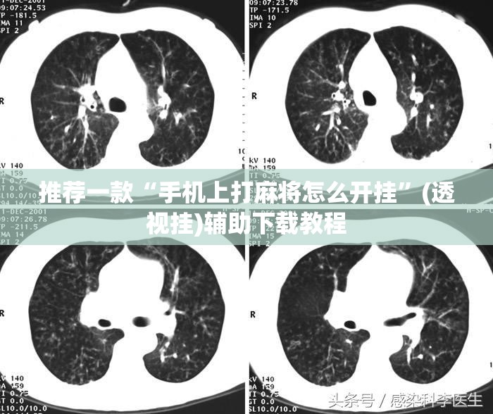 推荐一款“手机上打麻将怎么开挂”(透视挂)辅助下载教程