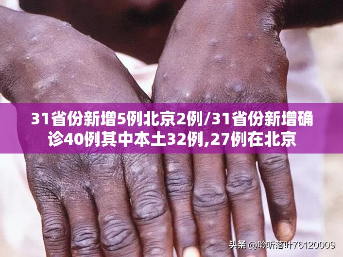 31省份新增5例北京2例/31省份新增确诊40例其中本土32例,27例在北京