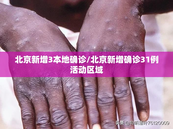 北京新增3本地确诊/北京新增确诊31例活动区域