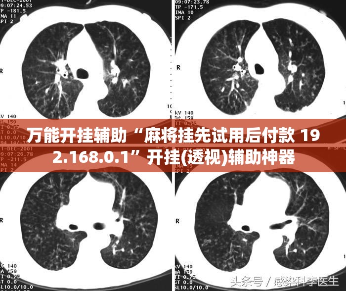 万能开挂辅助“麻将挂先试用后付款 192.168.0.1	”开挂(透视)辅助神器
