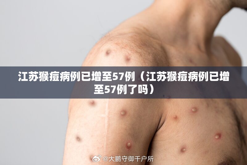 江苏猴痘病例已增至57例（江苏猴痘病例已增至57例了吗）