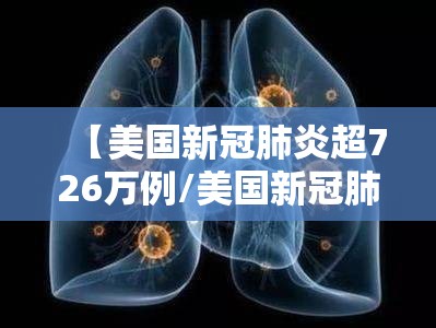 【美国新冠肺炎超726万例/美国新冠肺炎超2939万例】 【美国新冠肺炎超726万例/美国新冠肺炎超2939万例】