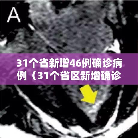 31个省新增46例确诊病例（31个省区新增确诊）