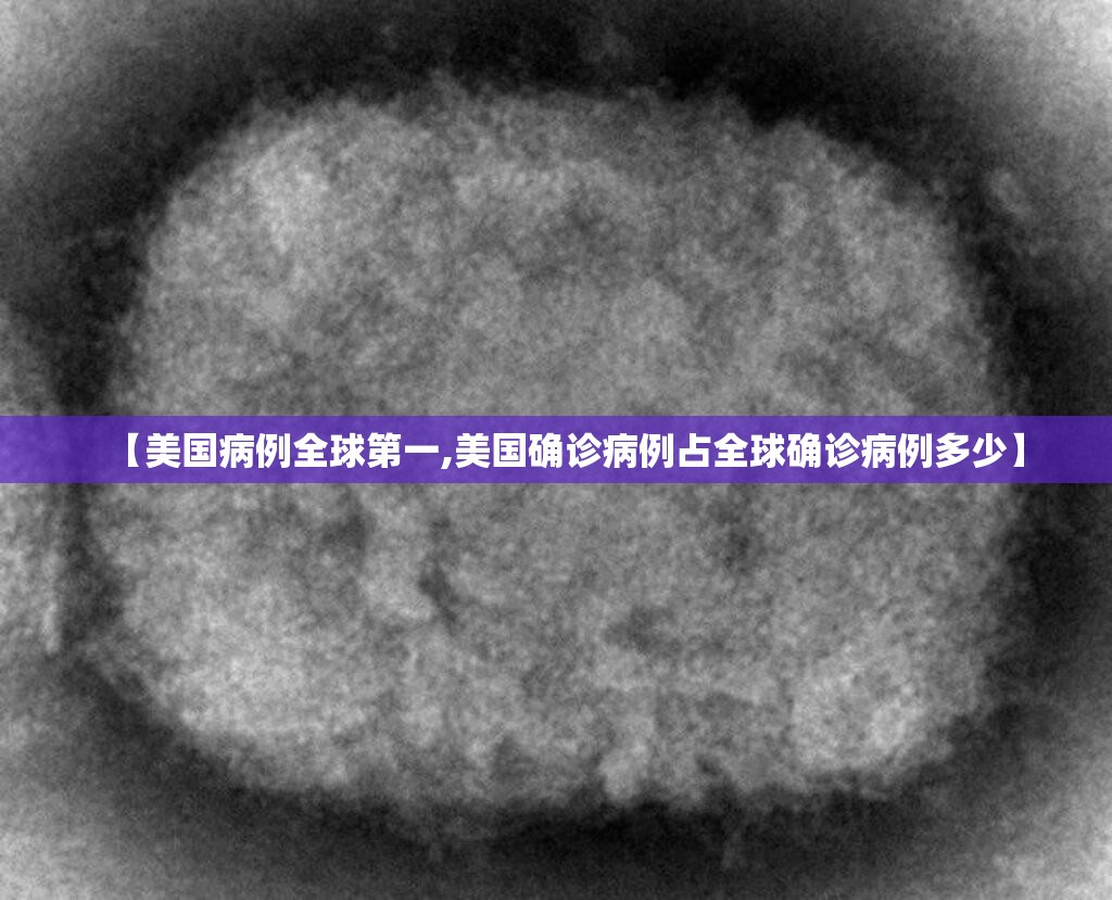 【美国病例全球第一,美国确诊病例占全球确诊病例多少】
