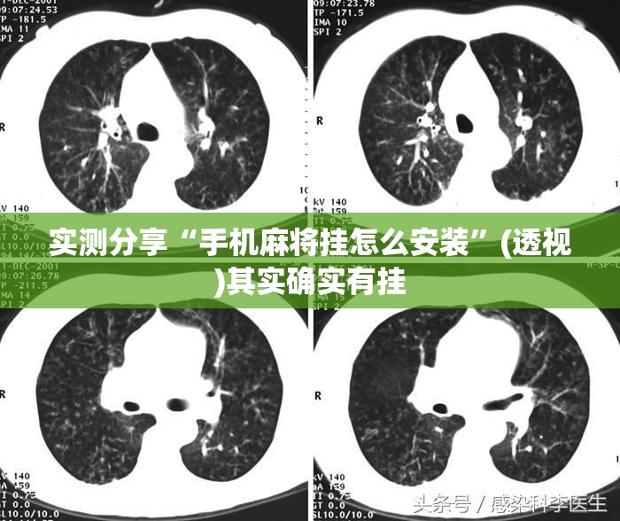实测分享“手机麻将挂怎么安装”(透视)其实确实有挂