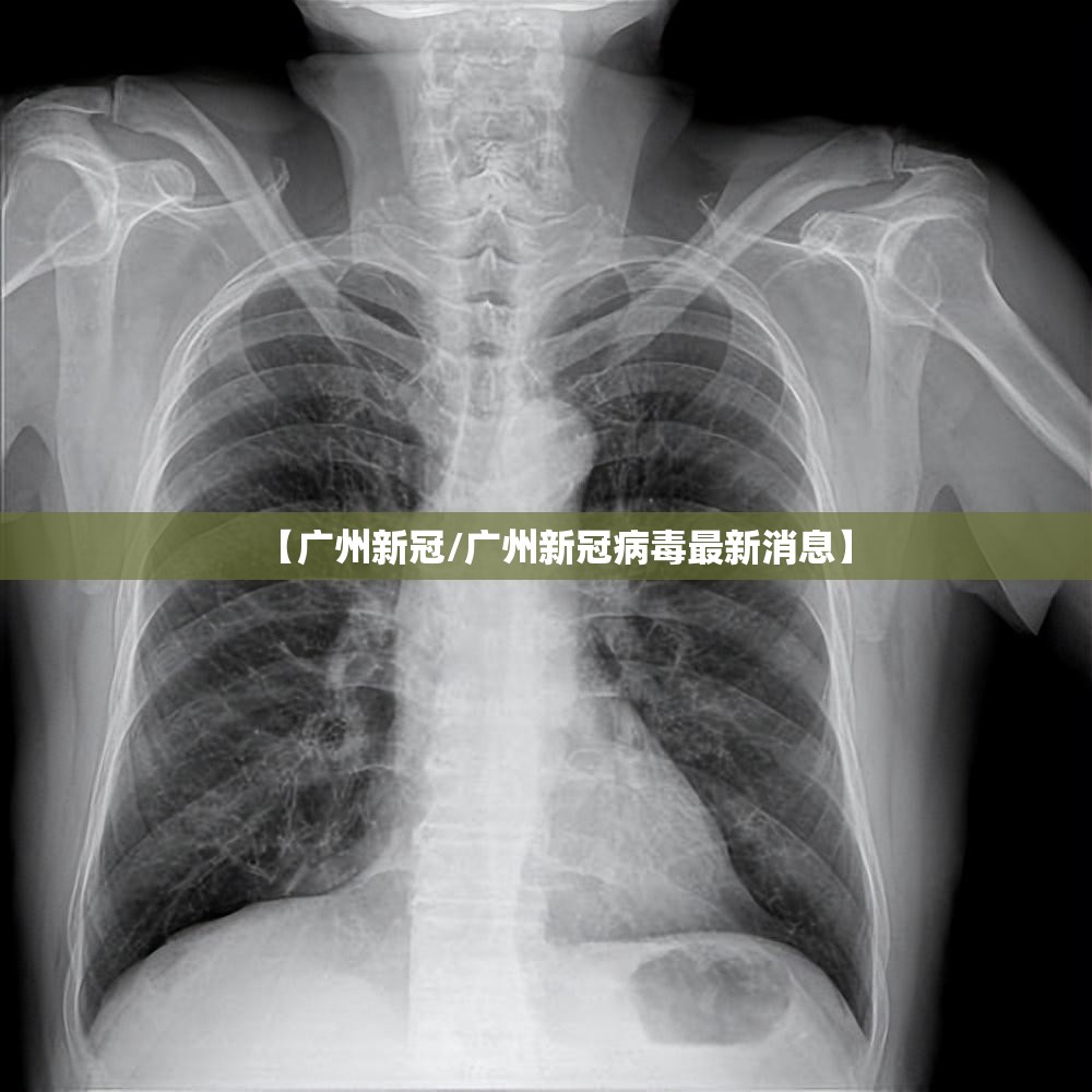 【广州新冠/广州新冠病毒最新消息】