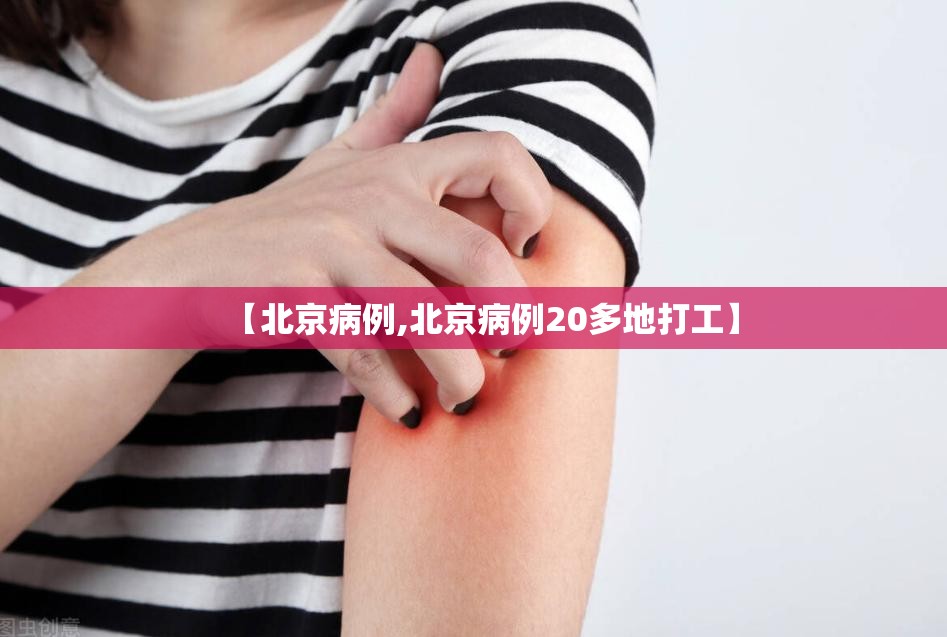 【北京病例,北京病例20多地打工】