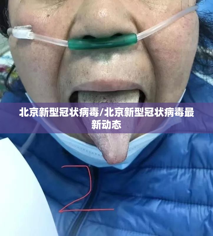 北京新型冠状病毒/北京新型冠状病毒最新动态 北京新型冠状病毒/北京新型冠状病毒最新动态