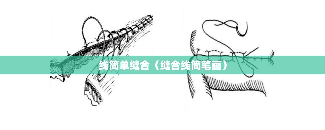 线简单缝合(缝合线简笔画) 线简单缝合(缝合线简笔画)