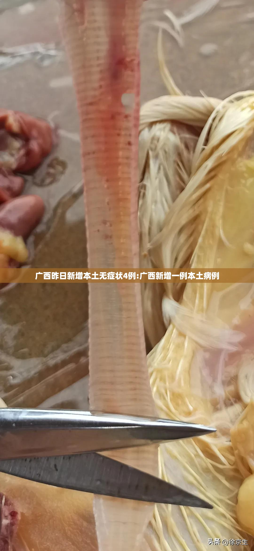 广西昨日新增本土无症状4例:广西新增一例本土病例 广西昨日新增本土无症状4例:广西新增一例本土病例