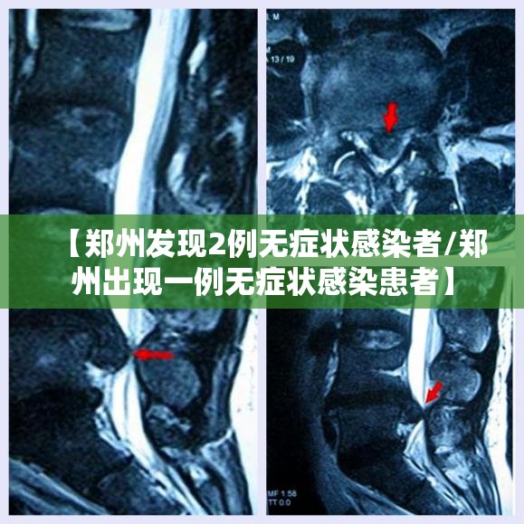 【郑州发现2例无症状感染者/郑州出现一例无症状感染患者】 【郑州发现2例无症状感染者/郑州出现一例无症状感染患者】