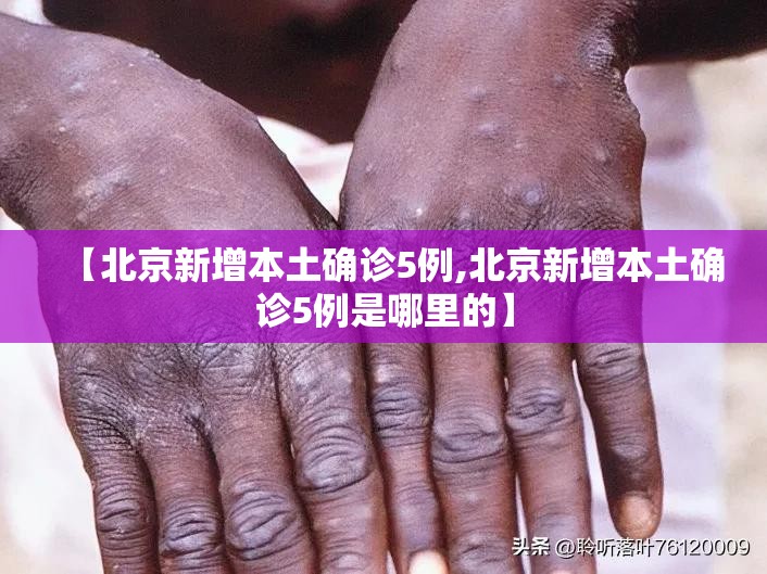 【北京新增本土确诊5例,北京新增本土确诊5例是哪里的】 【北京新增本土确诊5例,北京新增本土确诊5例是哪里的】