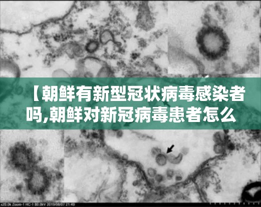 【朝鲜有新型冠状病毒感染者吗,朝鲜对新冠病毒患者怎么处理】 【朝鲜有新型冠状病毒感染者吗,朝鲜对新冠病毒患者怎么处理】