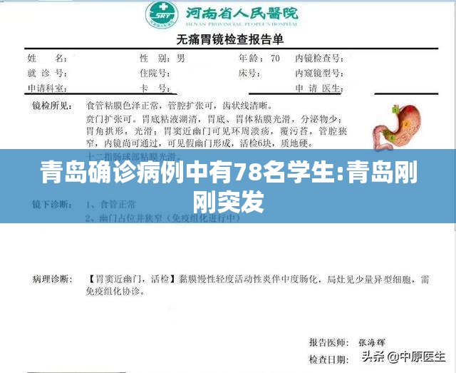 青岛确诊病例中有78名学生:青岛刚刚突发 青岛确诊病例中有78名学生:青岛刚刚突发
