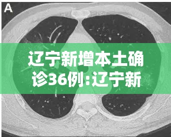 辽宁新增本土确诊36例:辽宁新冠肺炎最新病例 辽宁新增本土确诊36例:辽宁新冠肺炎最新病例