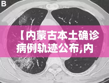 【内蒙古本土确诊病例轨迹公布,内蒙古新冠肺炎最新情况】 【内蒙古本土确诊病例轨迹公布,内蒙古新冠肺炎最新情况】