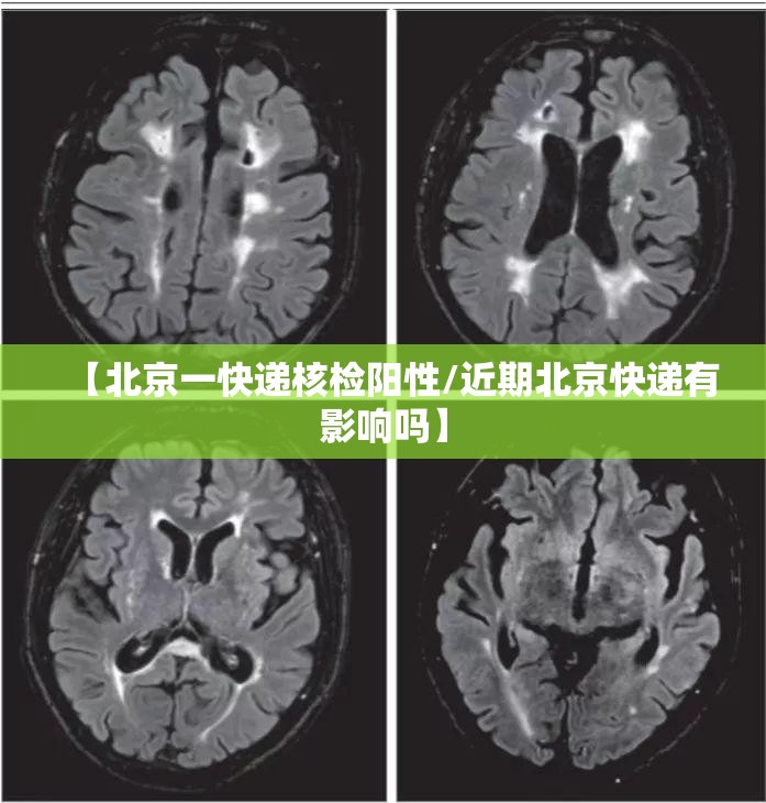 【北京一快递核检阳性/近期北京快递有影响吗】 【北京一快递核检阳性/近期北京快递有影响吗】