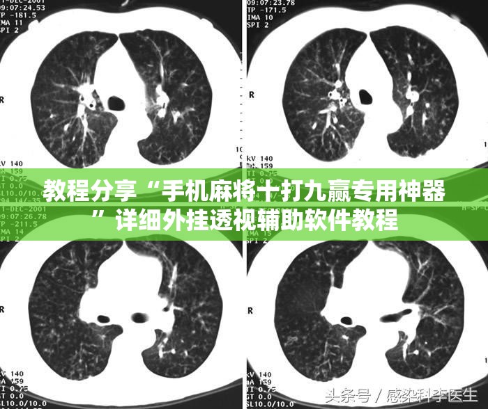 教程分享“手机麻将十打九赢专用神器	”详细外挂透视辅助软件教程