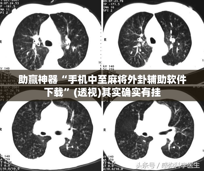 助赢神器“手机中至麻将外卦辅助软件下载	”(透视)其实确实有挂