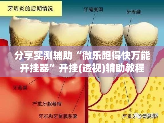 分享实测辅助“微乐跑得快万能开挂器	”开挂(透视)辅助教程