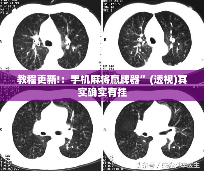 教程更新!：手机麻将赢牌器”(透视)其实确实有挂