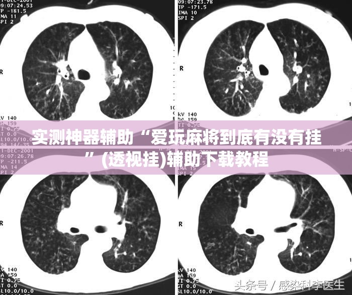 实测神器辅助“爱玩麻将到底有没有挂”(透视挂)辅助下载教程